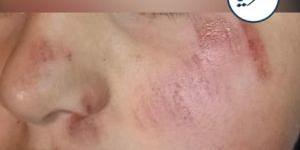 طالب يتعرض للضرب من ملثمين أمام مدرسته في الزرقاء (استمع) - تواصل نيوز