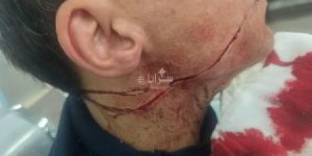 بـ22 غرزة في الوجه .. شاب يتعرض لاعتداء عنيف في بيادر وادي السير .. تفاصيل - صحيفة تواصل