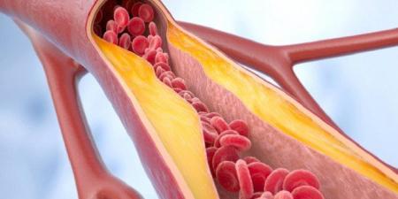 دهون “مفيدة” تحمي القلب… دراسة تكشف دورًا خفيًا في تنظيم ضغط الدم - تواصل نيوز