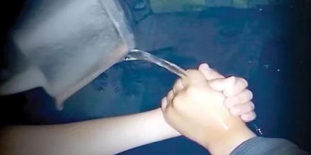 خطير.. تحذير مهم من نقابة الأطباء المصرية بشأن دعوات سكب المياه المغلية على اليدين - تواصل نيوز