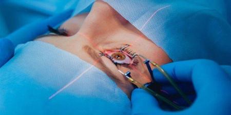 الصحة: إجراء 20 ألف عملية مياه بيضاء واستقبال مليوني مواطن في 2025 - تواصل نيوز