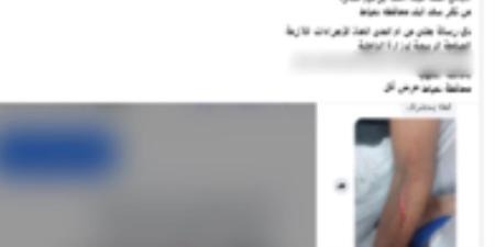 كشف ملابسات تضرر سيدة من تعدي طالب على نجلها بالضرب باستخدام سلاح أبيض وتهديدها - تواصل نيوز