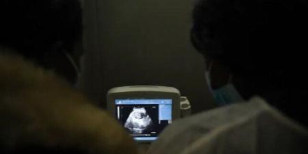 نزيف بسيط قاد لاكتشاف مفاجأة نادرة.. جنين في معدة طفلة مصرية.. التفاصيل الكاملة - تواصل نيوز