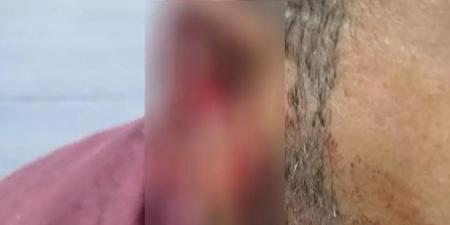 خلاف على «أسبقية الركوب» ينتهي بعض أذن محامٍ في المنوفية.. والمتهمة تروي التفاصيل - تواصل نيوز