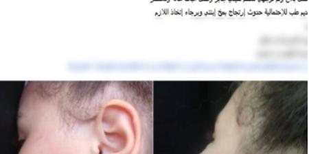 تعاني من فرط الحركة.. كشف ملابسات تعدي معلمة على تلميذة داخل مدرسة بالإسكندرية - تواصل نيوز