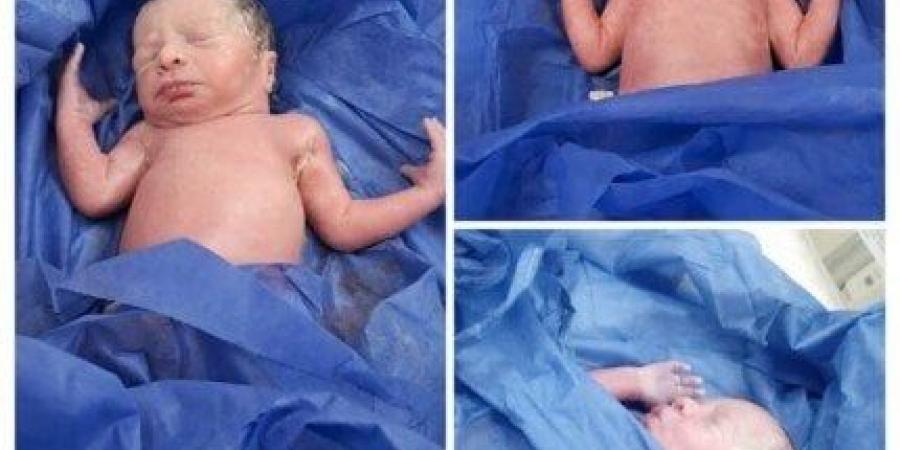 لأول مرة في المنيا.. ولادة نادرة لثلاثة توائم بمستشفى العدوة المركزي - تواصل نيوز