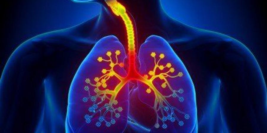 التغذية أثناء التهاب الشعب الهوائية.. الأطعمة التي يجب تجنبها لدعم صحة الرئة وتسريع التعافي - تواصل نيوز