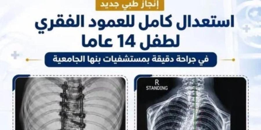 إنجاز طبى بمسنشفيات جامعة بنها  .. استعدال كامل للعمود الفقرى لطفل 14 عامًا - تواصل نيوز