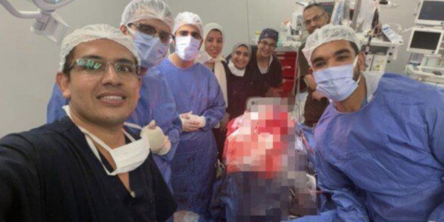 أطباء قصر العيني ينقذون حياة مريض باستخراج مسمار من الجمجمة بالقرب من شرايين المخ - تواصل نيوز
