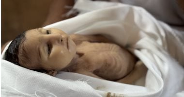 غدير: مآسي التجويع الإسرائيلي تتسبب في وفاة رضيع
